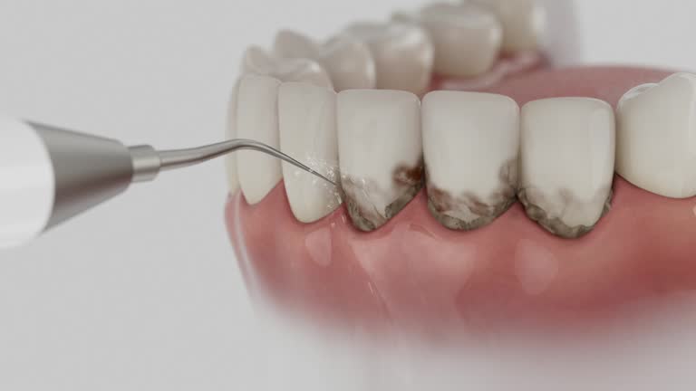 Reliable Dental Implants contractor in Horatio, AR by Smile Center Dentistry